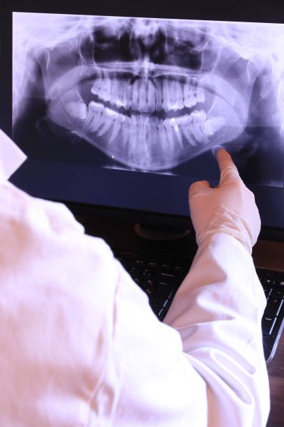 Best Holiday Emergency Dentist in Aptos Hills Larkin Valley, CA
