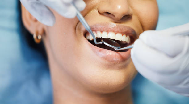 Best Emergency Dentist for Knocked-Out Tooth in Aptos Hills Larkin Valley, CA